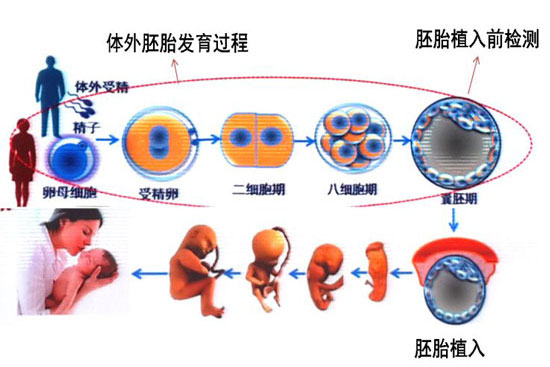 什么叫第三代做试管婴儿